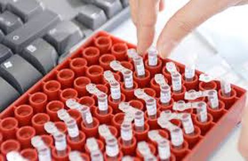 Agențiile Antidoping suferă din cauza pandemiei de coronavirus