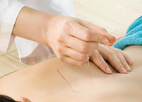 Descoperă puterea acupuncturii: Cum poate îmbunătăți sănătatea și starea de bine