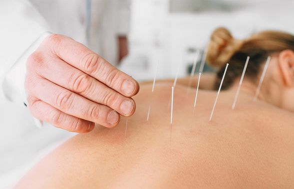 Scapă de obezitate prin acupunctură și printr-un stil de viață sănătos !