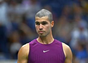 O eroare a făcut ca Alcaraz să rămână fără păr înainte de US Open! Ibericul a povestit în detaliu incidentul