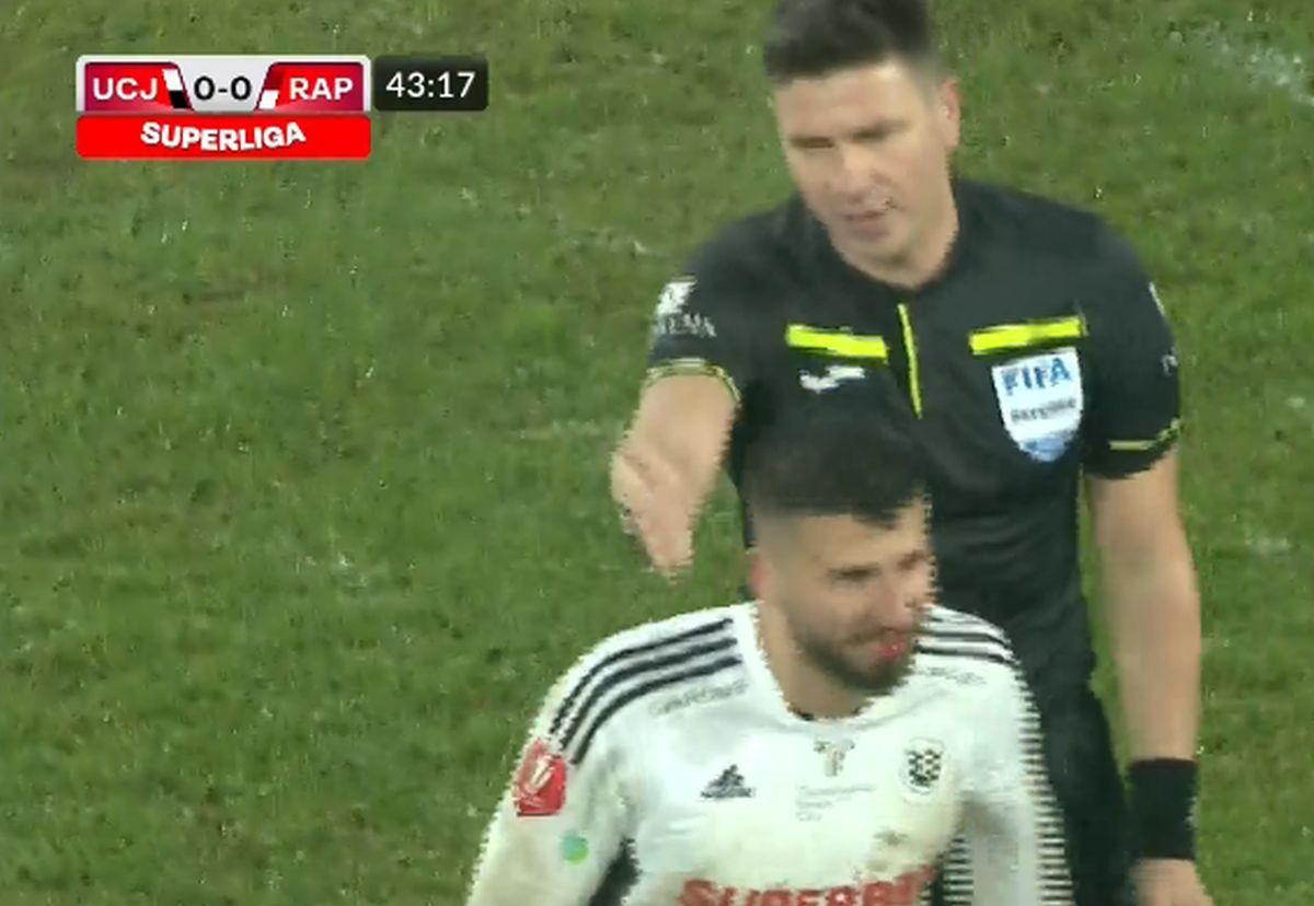 „Accidentat” de arbitru » „Centralul” l-a însângerat pe jucătorul din Superligă