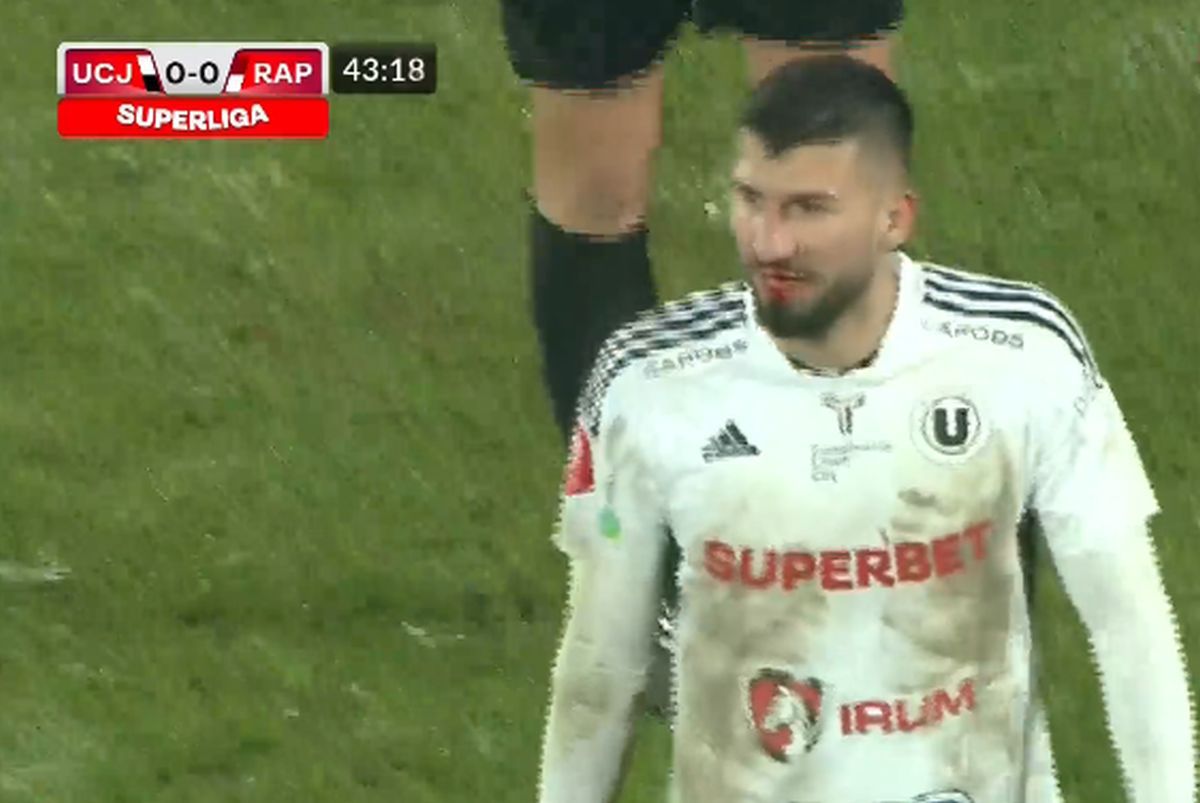 „Accidentat” de arbitru » „Centralul” l-a însângerat pe jucătorul din Superligă