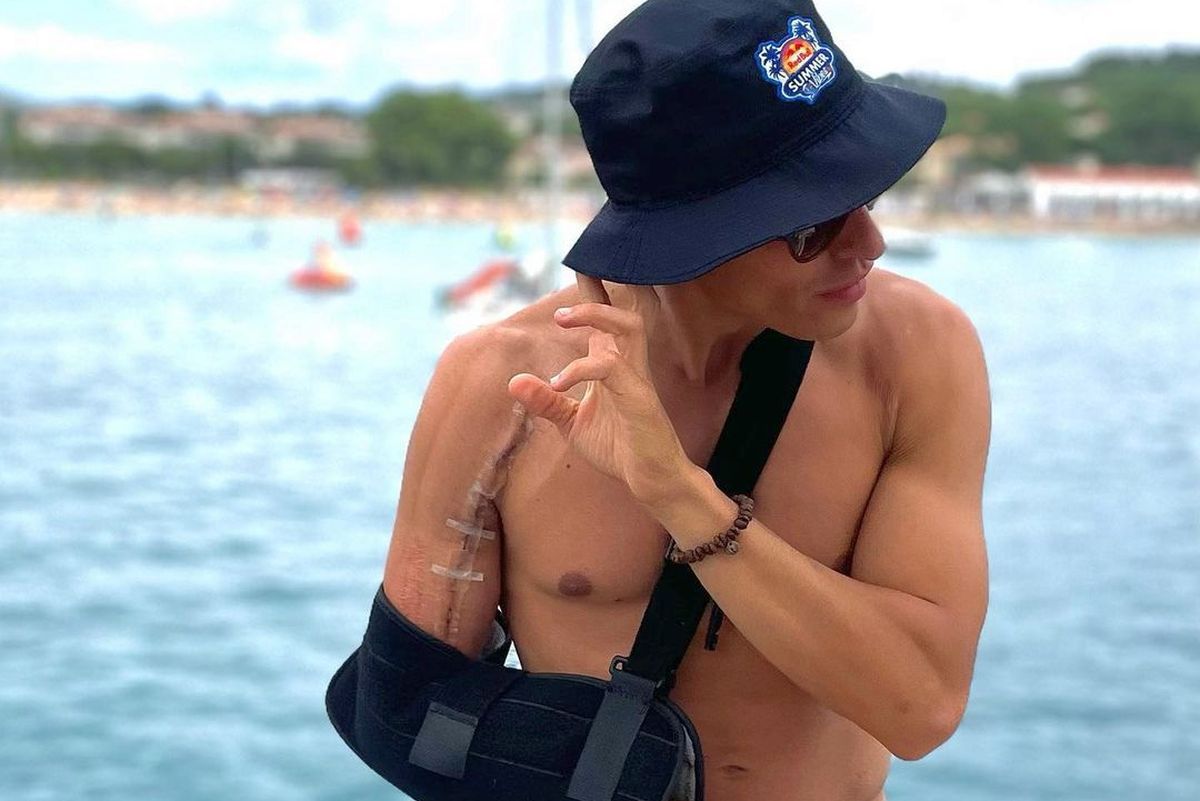 Marc Marquez și-a arătat în premieră cicatricea » Cum arată umărul după accidentarea horror din martie