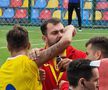 Rareș Burnete, accidentare incredibilă în România U19 - Austria U19