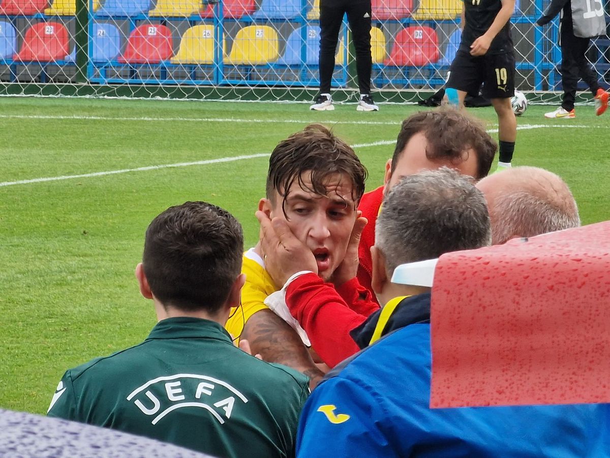 Rareș Burnete, accidentare incredibilă în România U19 - Austria U19