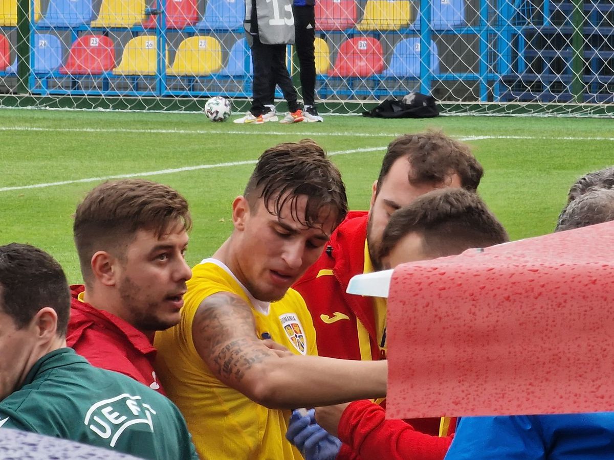 Rareș Burnete, accidentare incredibilă în România U19 - Austria U19
