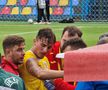 Rareș Burnete, accidentare incredibilă în România U19 - Austria U19