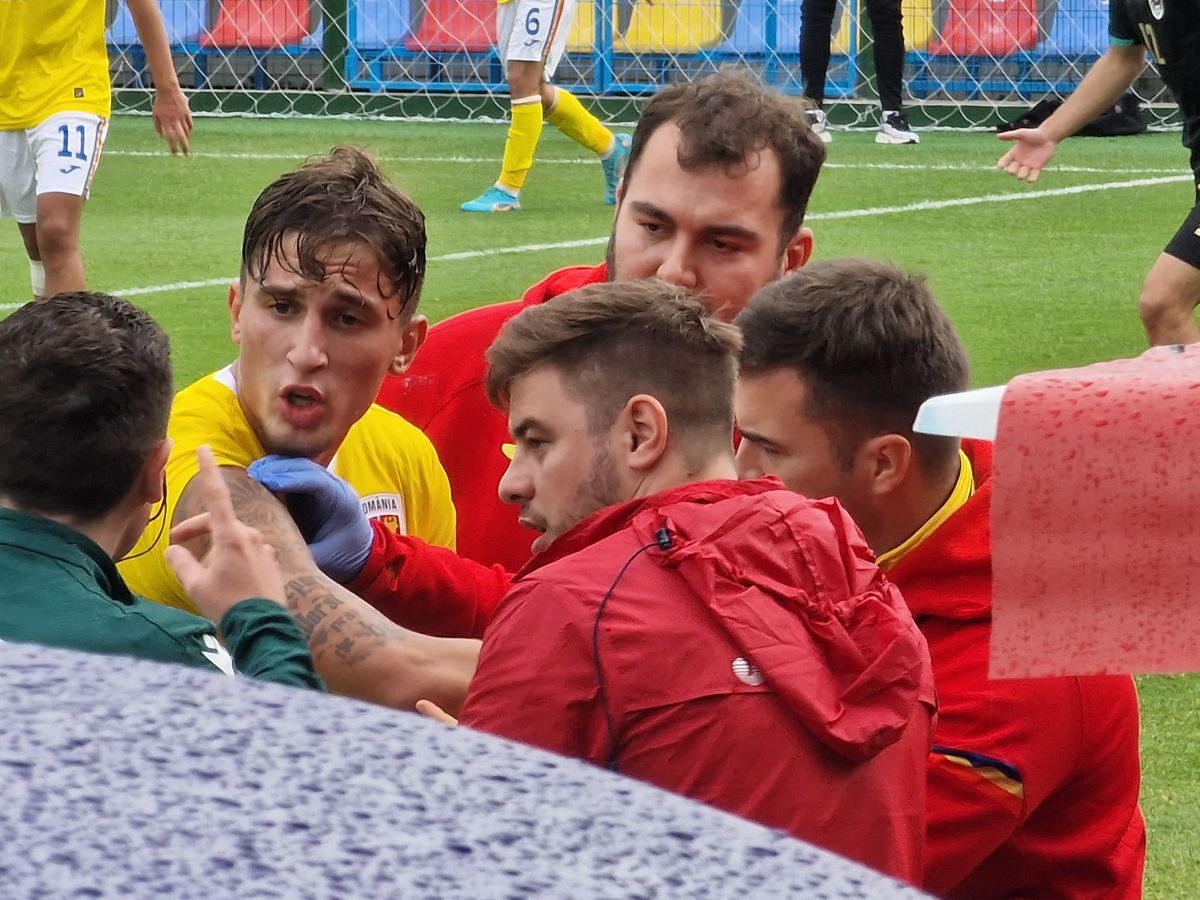 Rareș Burnete, accidentare incredibilă în România U19 - Austria U19