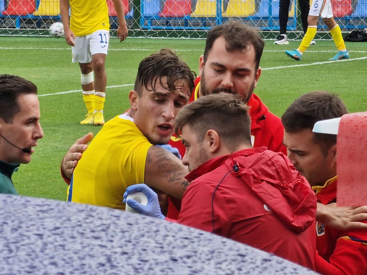 Rareș Burnete, accidentare incredibilă în România U19 - Austria U19