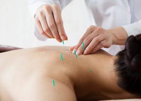Tot ce trebuie să știm despre beneficiile pentru sănătate ale acupuncturii