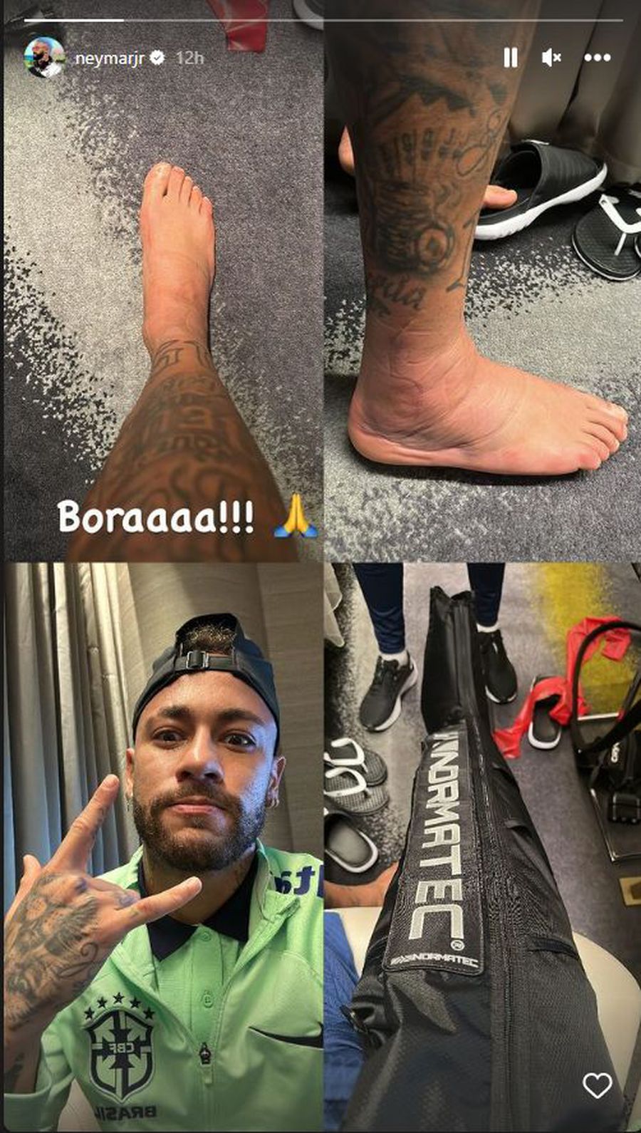 Fotografia postată de Neymar la Insta Story. Foto: Instagram, @NeymarJr Imaginea dură postată de Neymar și mesajul acestuia » Cum arată glezna starului brazilian după duelul „contondent” cu sârbii