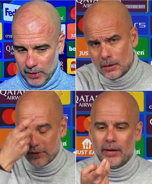 Imagini incredibile cu rănile lui Guardiola