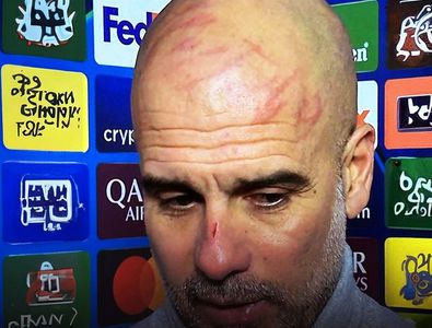 Imagini ȘOCANTE cu Pep Guardiola însângerat după egalul cu Feyenoord! Ce ...