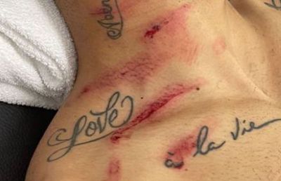 Portarul Ecuadorului, lovitură de arte marțiale asupra lui Matheus Cunha » Atacantul lui Atletico s-a ales cu mai multe răni în zona gâtului