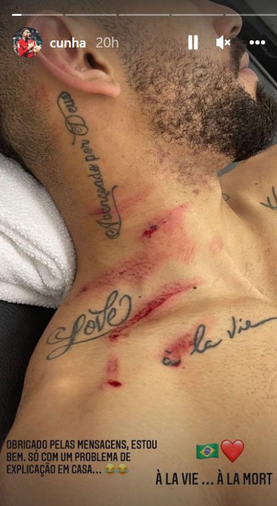 Portarul Ecuadorului, lovitură de arte marțiale asupra lui Matheus Cunha » Atacantul lui Atletico s-a ales cu mai multe răni în zona gâtului