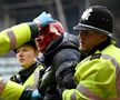 Un fan plin de sânge scos de polițiști de pe teren Foto: Guliver/GettyImages