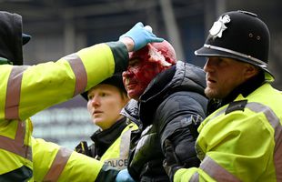 Sânge și fani pe teren! Incidente grave în Cupa Angliei » West Brom - Wolves, suspendat 34 de minute după confruntarea violentă din tribune