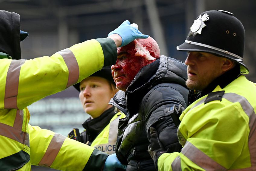 Un fan plin de sânge scos de polițiști de pe teren Foto: Guliver/GettyImages