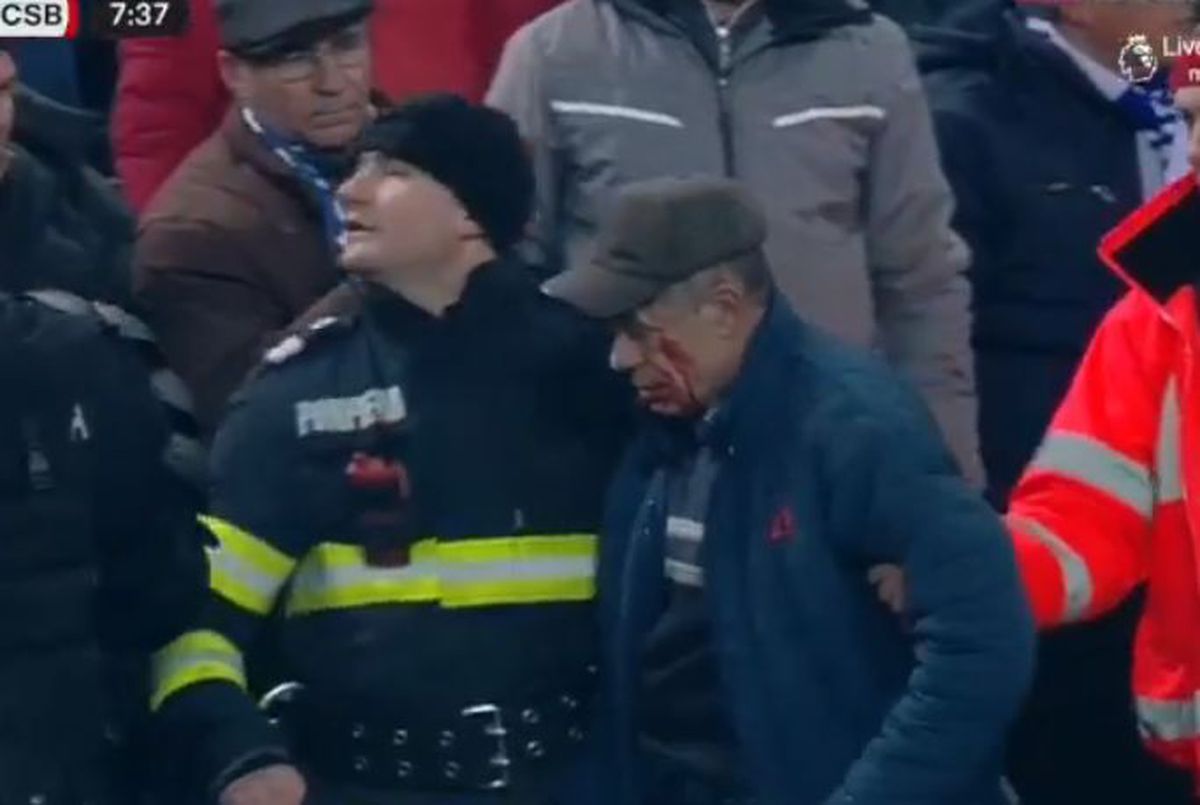 Ce a pățit suporterul din cauza căruia a fost întrerupt duelul Craiova - FCSB » Însângerat, a fost urcat în ambulanță