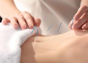 Beneficiile surprinzătoare ale acupuncturii: cum vă poate îmbunătăți sănătatea această practică străveche