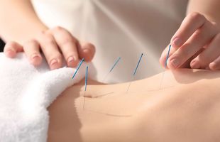 Beneficiile surprinzătoare ale acupuncturii: cum vă poate îmbunătăți sănătatea această practică străveche