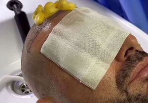 Adrian Mutu, la prima apriție publică după ce și-a făcut implant de păr