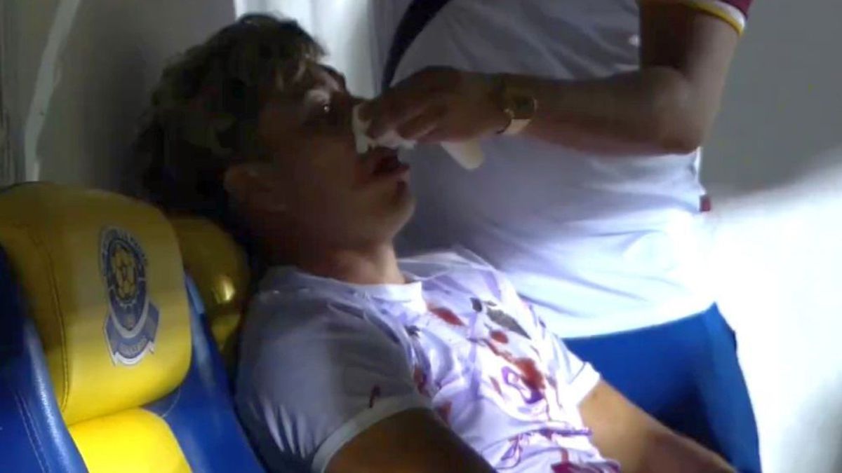 Bătaie cruntă la un meci de fotbal din Mexic » Portarul a ajuns în ambulanță!