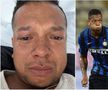 Fredy Guarin