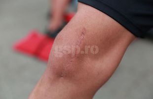 Panțîru e iarăși fotbalist, după doi ani și două luni de calvar! » Și-a lăsat fotografiat în detaliu genunchiul operat de 3 ori