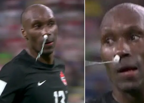 Moment incredibil la Campionatul Mondial: a jucat cu un tampon în nas!