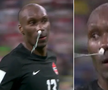 Atiba Hutchinson (39 de ani, mijlocaș defensiv) a folosit un tampon pentru a-și opri hemoragia nazală în timpul partidei Croația - Canada 4-1.