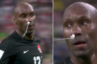 Moment nemaivăzut pe un teren de fotbal: a jucat cu un tampon în nas la Mondial!