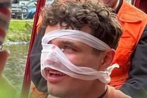 S-a distrat prea tare » Pilotul de Formula 1, cu fața însângerată după o petrecere în Amsterdam
