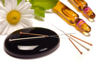 De ce acupunctura poate fi benefică în unele probleme de sănătate