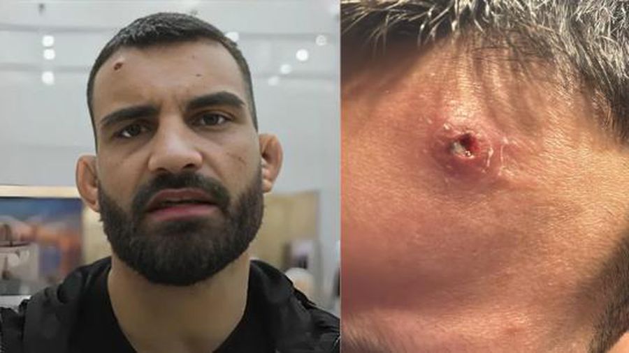 „Pandemia tăcută” din UFC face ravagii » Inclusiv Merab Dvalishvili, campionul categoriei „cocoș”, a avut de suferit! Toți din fenomen sunt expuși