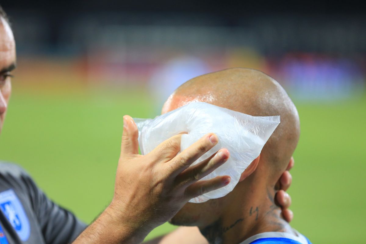 L-a învinețit pe Mitriță » Palma lui Ajeti i-a provocat un hematom serios vedetei Universității Craiova