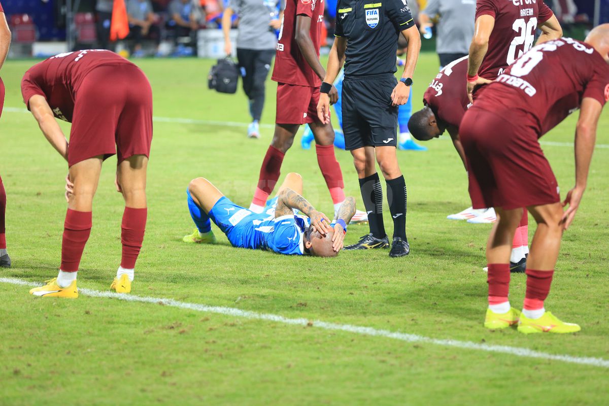 L-a învinețit pe Mitriță » Palma lui Ajeti i-a provocat un hematom serios vedetei Universității Craiova