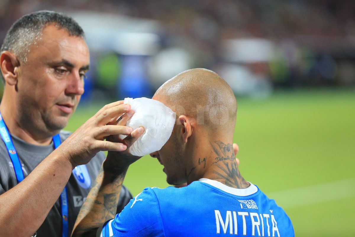 L-a învinețit pe Mitriță » Palma lui Ajeti i-a provocat un hematom serios vedetei Universității Craiova