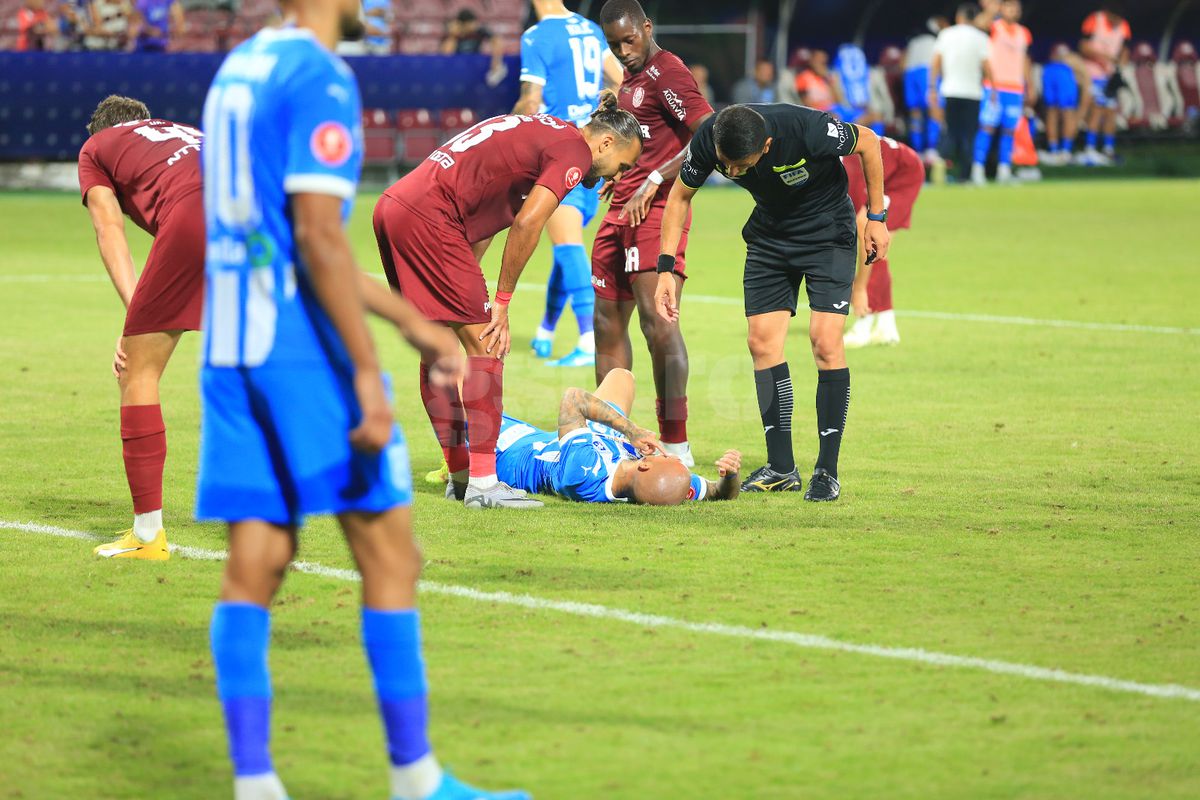 L-a învinețit pe Mitriță » Palma lui Ajeti i-a provocat un hematom serios vedetei Universității Craiova