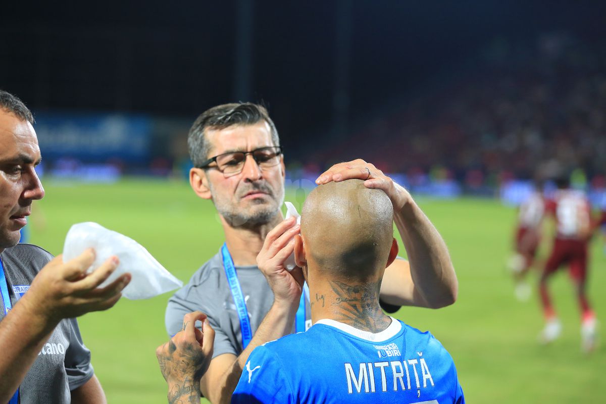 L-a învinețit pe Mitriță » Palma lui Ajeti i-a provocat un hematom serios vedetei Universității Craiova