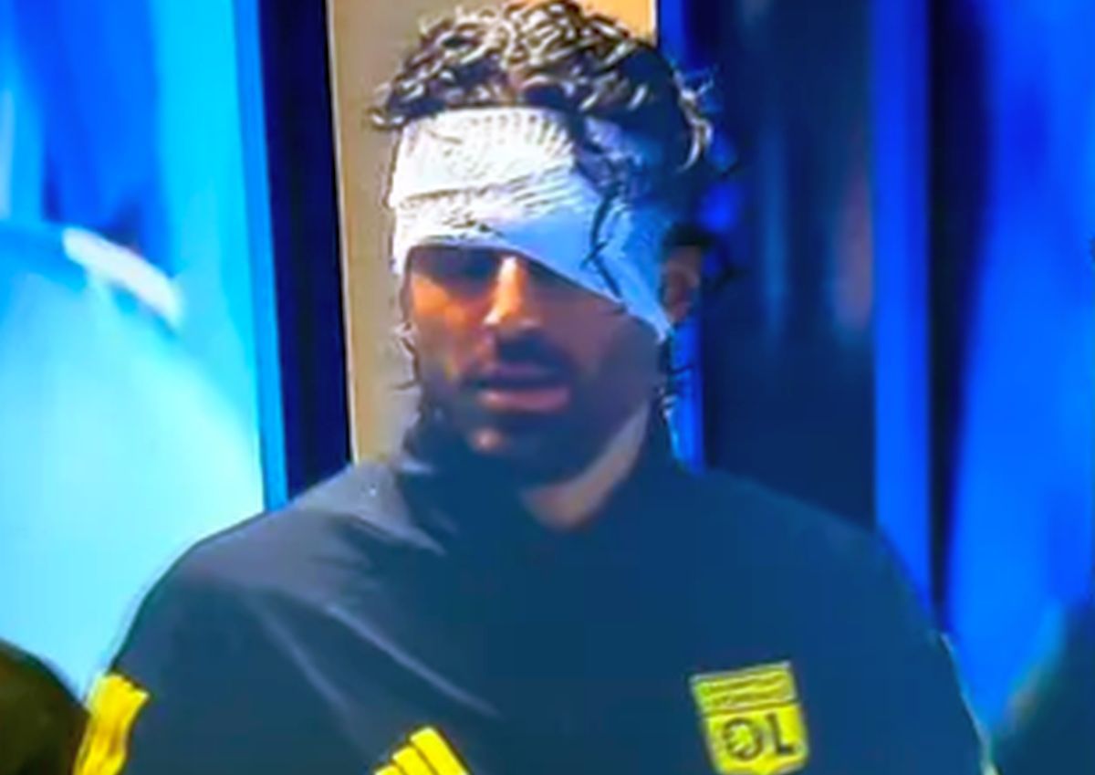 Dezvăluiri despre starea lui Fabio Grosso, rănit de huliganii lui Marseille: „Nu putea susține o conversație, nu părea lucid!”