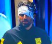 Dezvăluiri despre starea lui Fabio Grosso, rănit de huliganii lui Marseille: „Nu putea susține o conversație, nu părea lucid!”