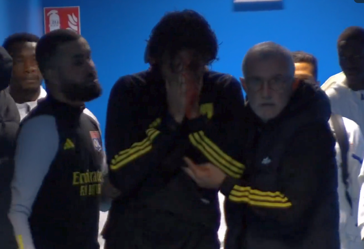 Dezvăluiri despre starea lui Fabio Grosso, rănit de huliganii lui Marseille: „Nu putea susține o conversație, nu părea lucid!”