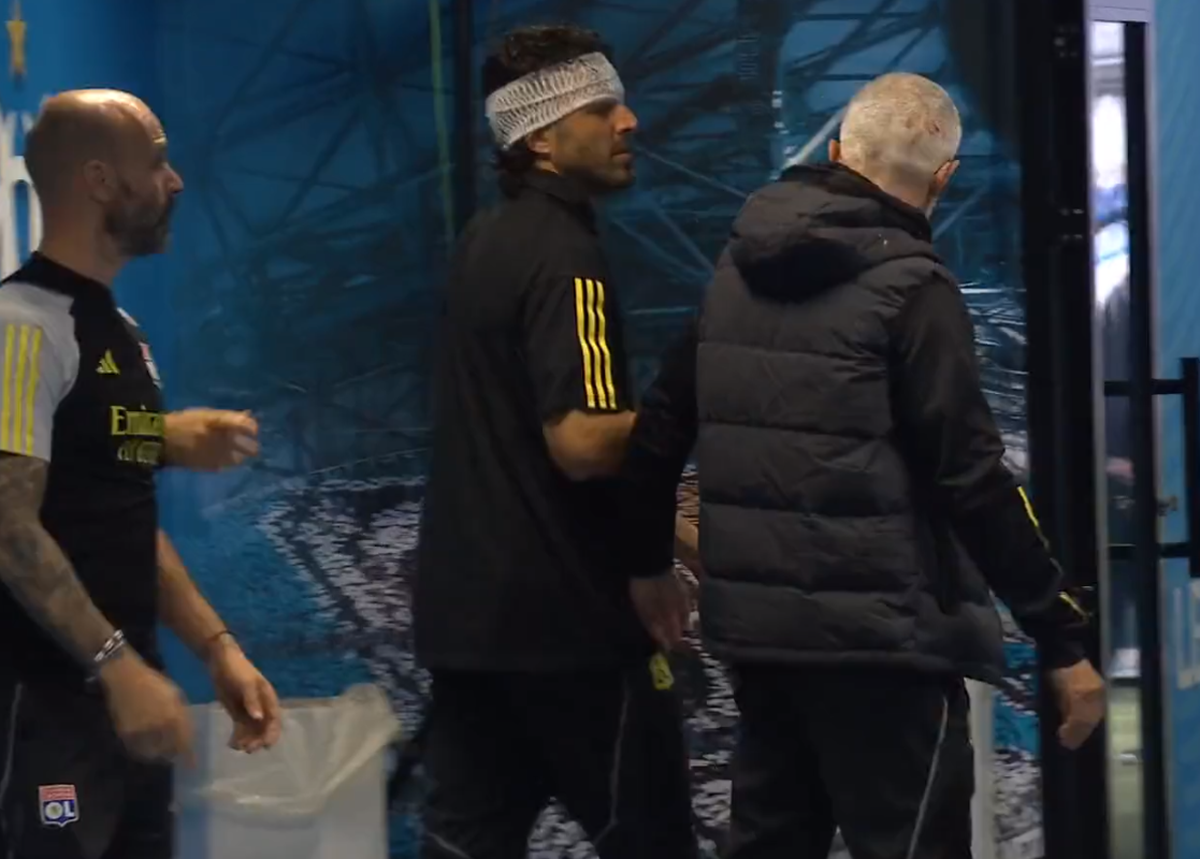 Fabio Grosso, imagini ȘOCANTE din Franța! Antrenorul lui Lyon, plin de sânge după ce autocarul a fost atacat de ultrașii lui Marseille! Meciul poate fi amânat