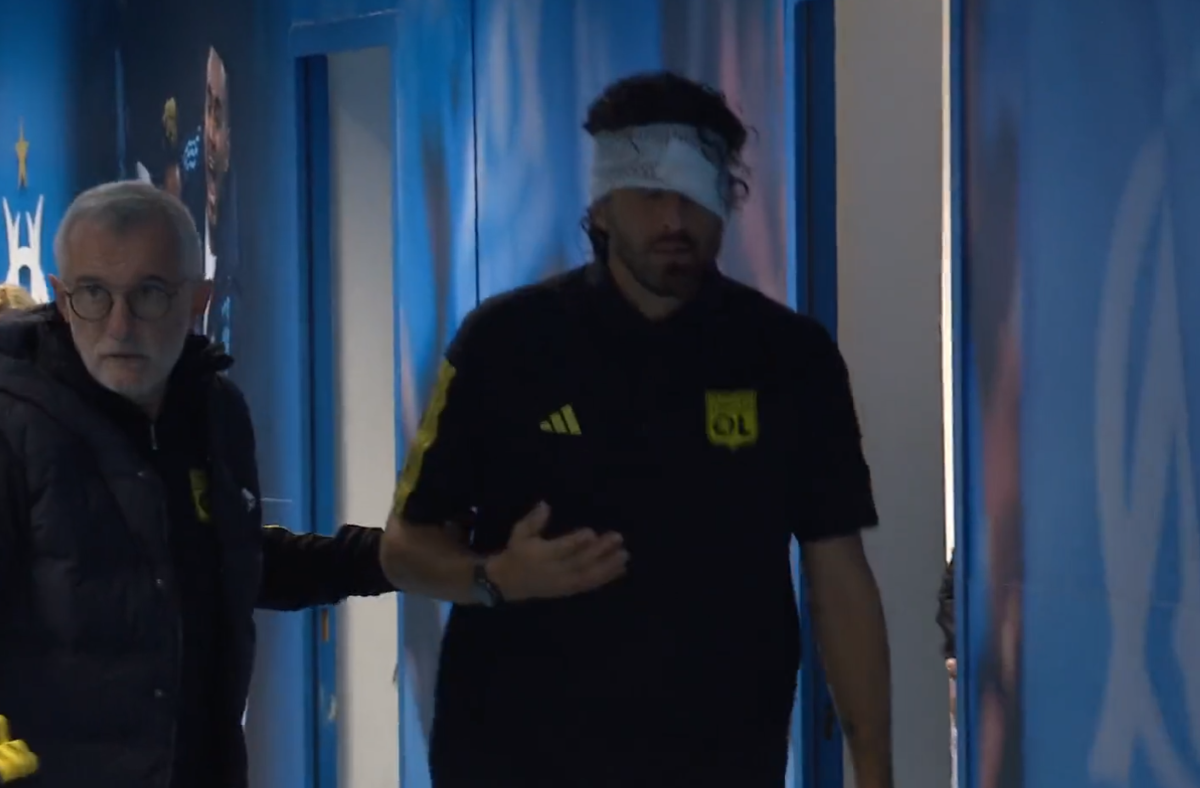 Fabio Grosso, imagini ȘOCANTE din Franța! Antrenorul lui Lyon, plin de sânge după ce autocarul a fost atacat de ultrașii lui Marseille! Meciul poate fi amânat