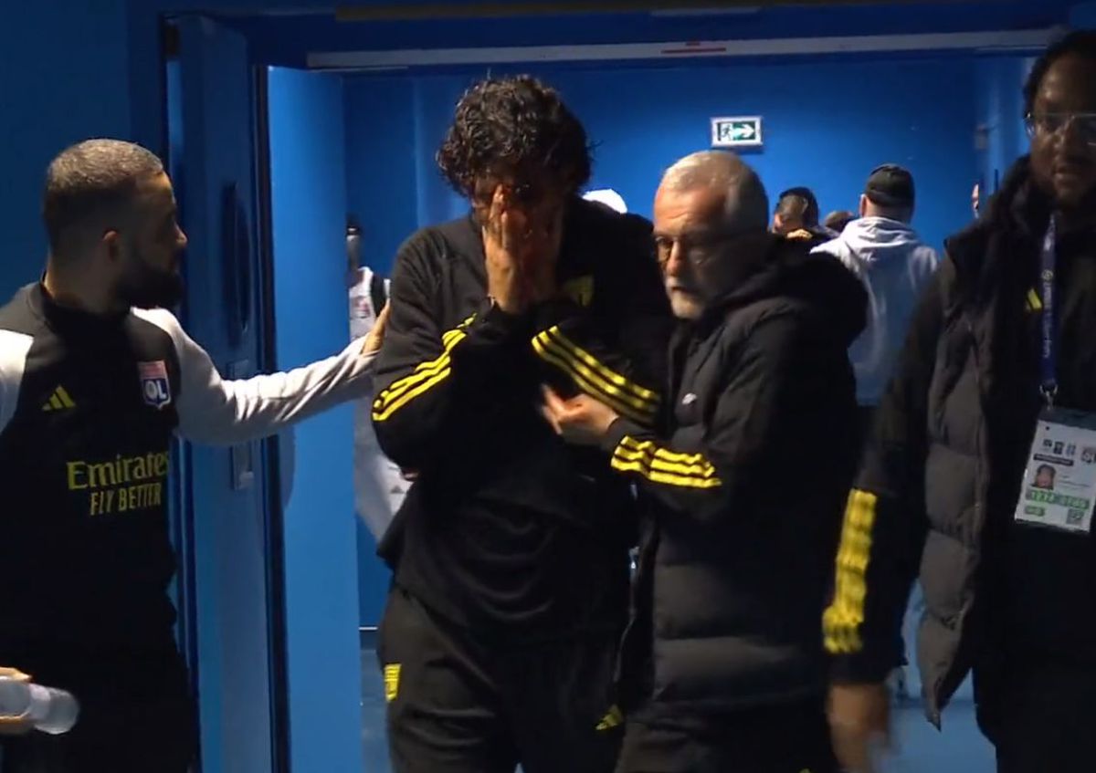 Cum arată fața lui Fabio Grosso, a doua zi după ce a fost atacat cu pietre de ultrașii lui Marseille