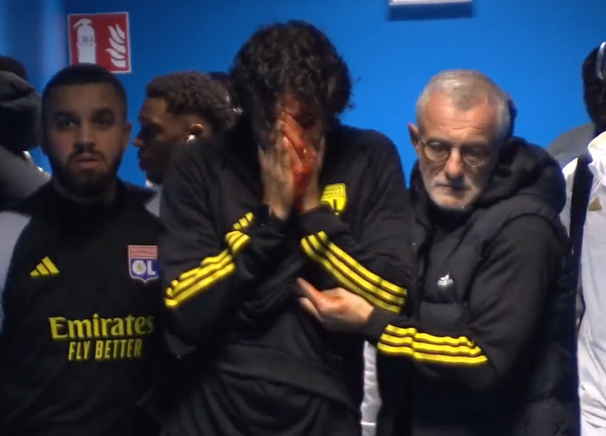 Dezvăluiri despre starea lui Fabio Grosso, rănit de huliganii lui Marseille: „Nu putea susține o conversație, nu părea lucid!”