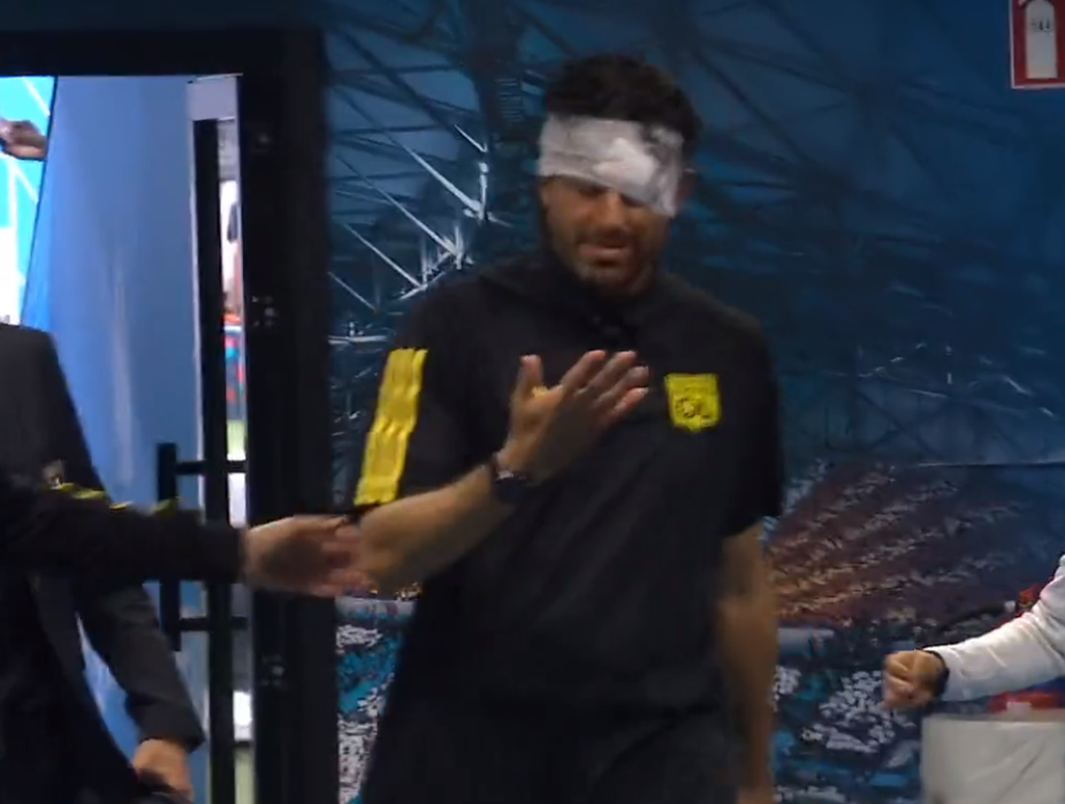 Cum arată fața lui Fabio Grosso, a doua zi după ce a fost atacat cu pietre de ultrașii lui Marseille