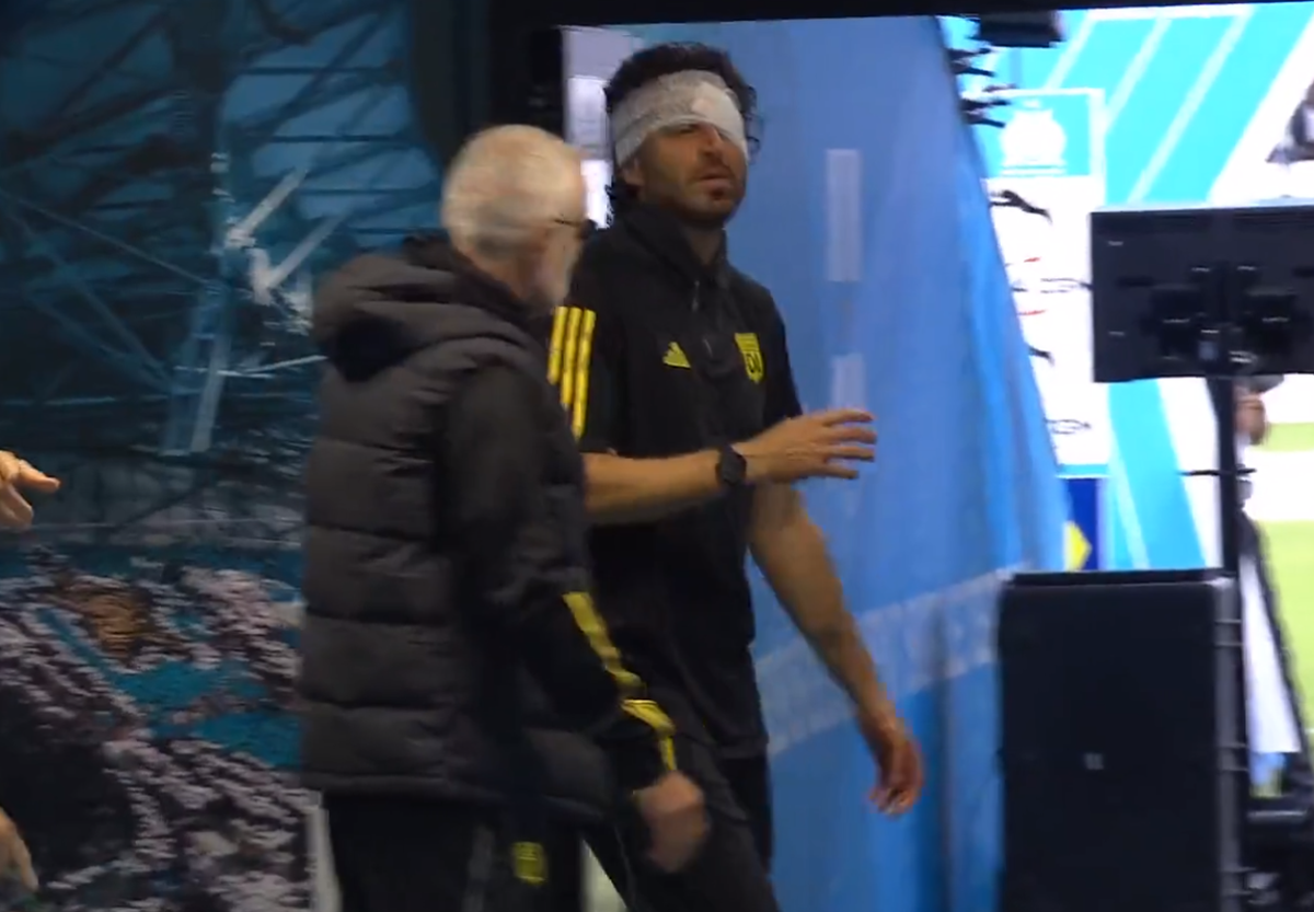 Fabio Grosso, imagini ȘOCANTE din Franța! Antrenorul lui Lyon, plin de sânge după ce autocarul a fost atacat de ultrașii lui Marseille! Meciul poate fi amânat