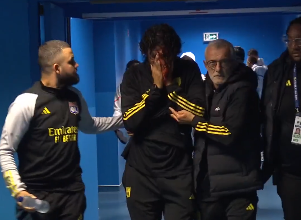 Comoție și 10 puncte de sutură pentru Fabio Grosso! Ministrul Sportului francez atacă dur: „E deprimant și dezgustător”